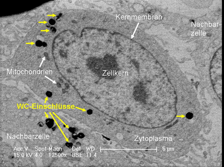 碳化鎢納米顆粒/碳化鎢粉會(huì)對(duì)人體健康有毒有害嗎？插圖